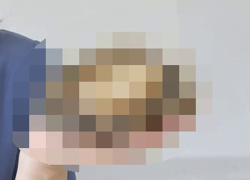 処理後：アワビの中央と外周を覆ったモザイク